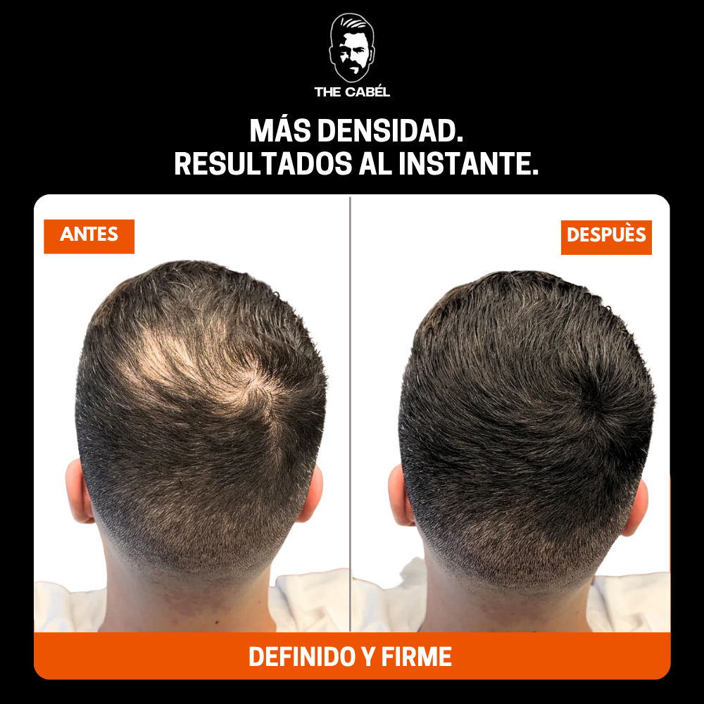 DENSITY FIX™