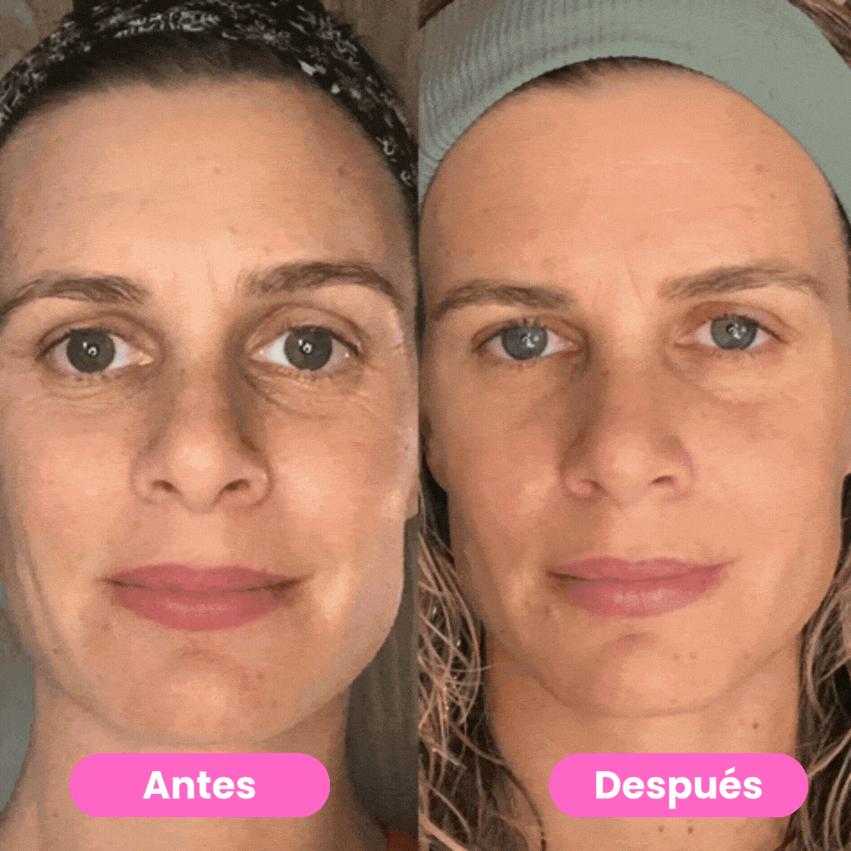 Glowify™ -Terapia LED Facial 3-en-1
