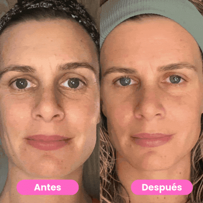 Glowify™ -Terapia LED Facial 3-en-1